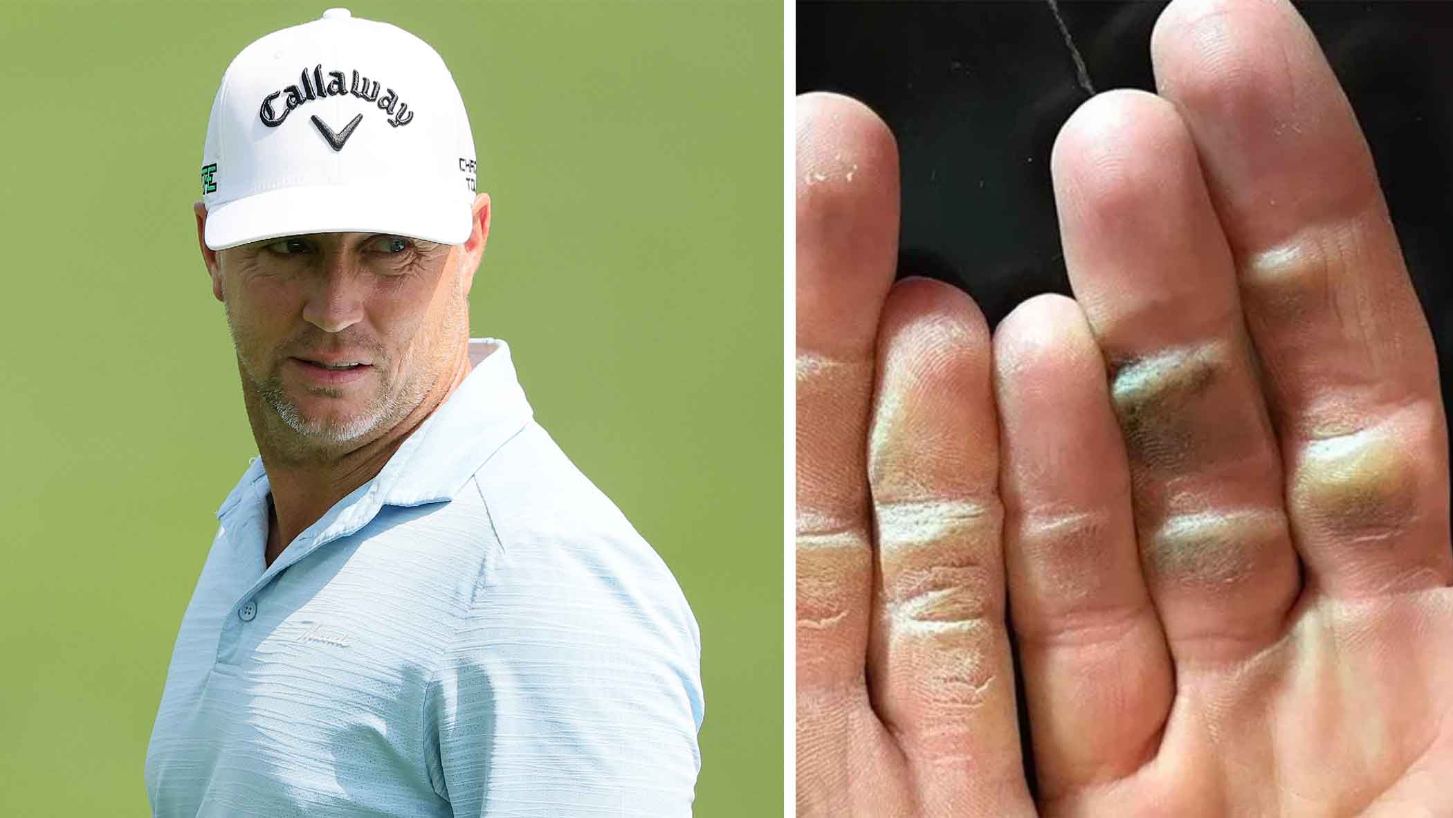 Alex Noren's gnarled hands went viral. They reveal a lot about the man